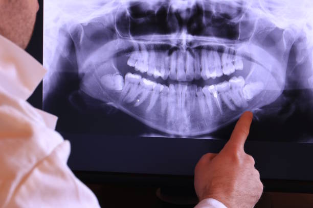 Best Cracked Tooth Emergency Dentist  in Willow Street, PA