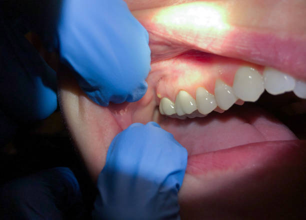 Best Knocked-Out Tooth Emergency  in Willow Street, PA